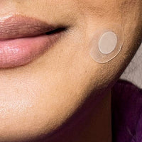 Thumbnail for Blemish & Wrinkle Patch with Microneedle Technology